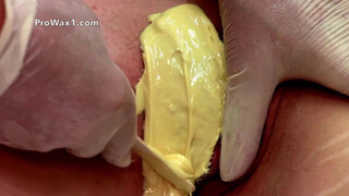 1. vagina hair removal tutorial section of waxing step by step education video