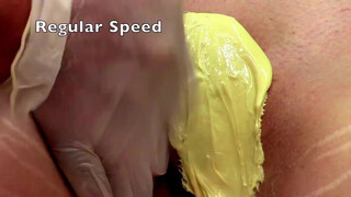 5. vagina hair removal tutorial section of waxing step by step education video