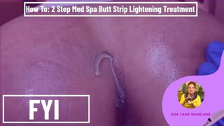 2 Step Med Spa Butt Strip Lightening Treatment (How To)