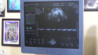 8. Why is the sexual response complicated at the end of pregnancy? 2nd part