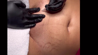 5. Post Bikini Brazilian Wax| Vajacial Demo