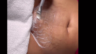 2. Post Bikini Brazilian Wax| Vajacial Demo