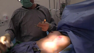 9. Breast Augmentation | Pectus Excavatum Surgery | Dr. Daniel Barrett | Beverly Hills