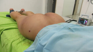 5. Case 247 Video 8: Fat grafting buttocks augmentation