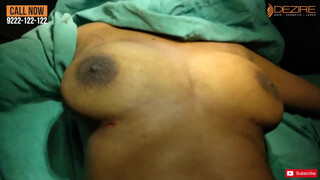 10. Female Scarless Breast Reduction  Dr. Prashant . Dezire Clinic India