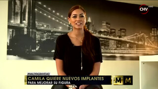 3. Camila Recabarren cambió sus implantes para mejorar su figura – Maldita Moda