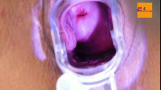 8. Female Anatomy Vaginal Test EXAM | Vagina and Vulva Examination