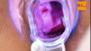 10. Female Anatomy Vaginal Test EXAM | Vagina and Vulva Examination